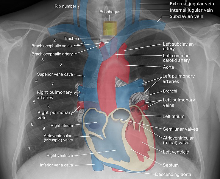 740px-Mediastinal_structures_on_chest_X-ray,_annotated.jpg
