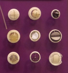 Mechanical_heart_valves