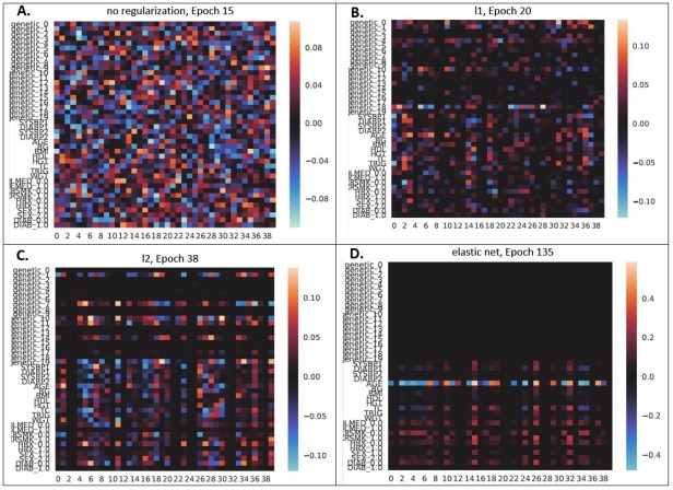 Regularization for Neural Networks with Framingham Case Study – Glass ...