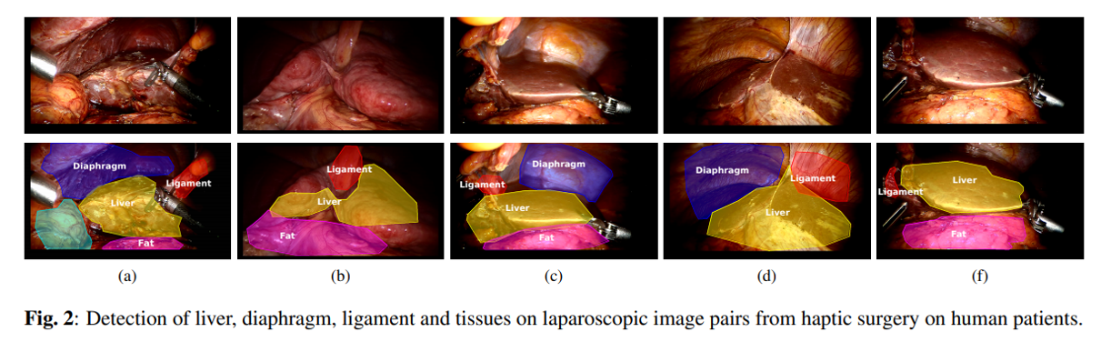 lap-surgery-multiple