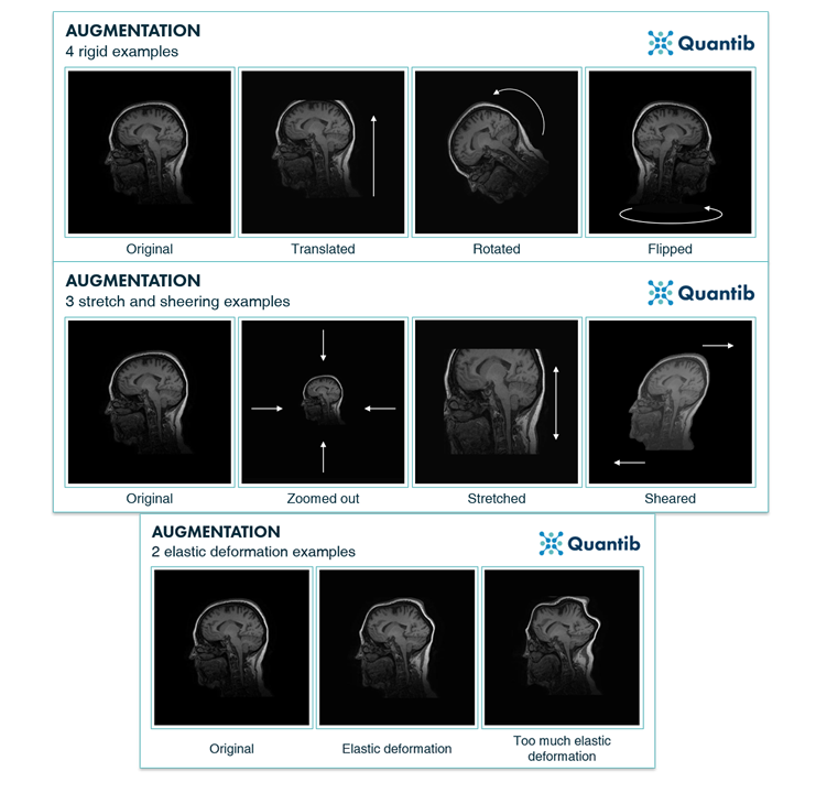 quantib-deformations