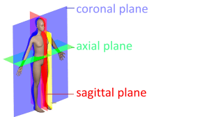 AxialCoronalSagittal