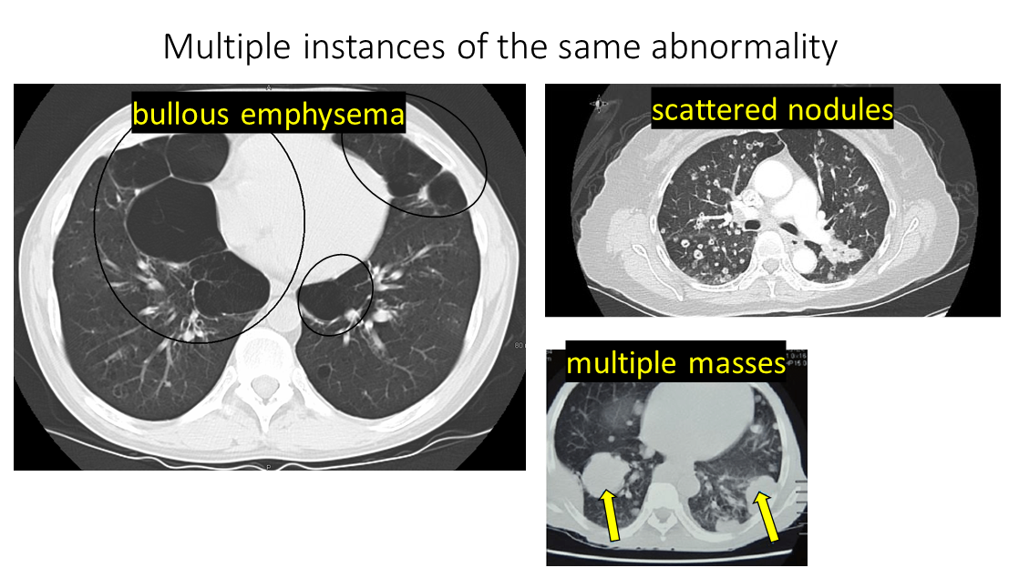 challenge-4-multi-same-abn