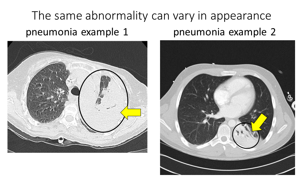 challenge-6-same-abn-vary-in-appearance