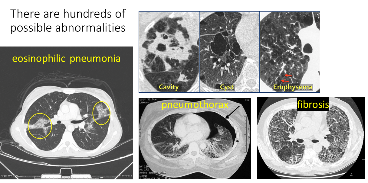 hundreds-of-possible-abn