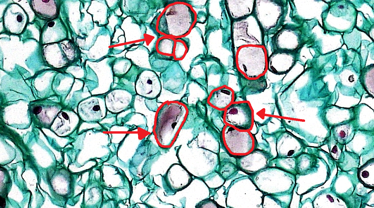 Gymnosperm_Stem_Cork_and_Cortex_in_Pinus_Wood_(36348377021)