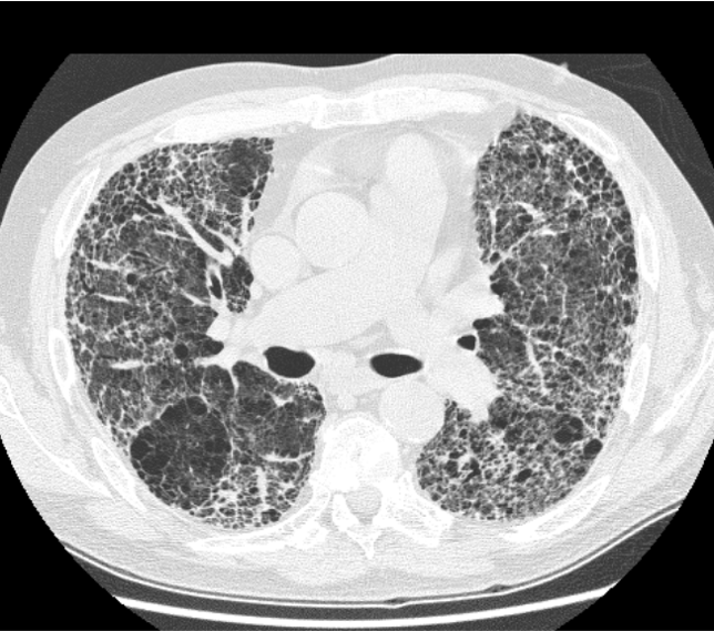 Downloading and Preprocessing Medical Images in Bulk: DICOM to NumPy ...