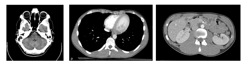 Downloading and Preprocessing Medical Images in Bulk: DICOM to NumPy ...