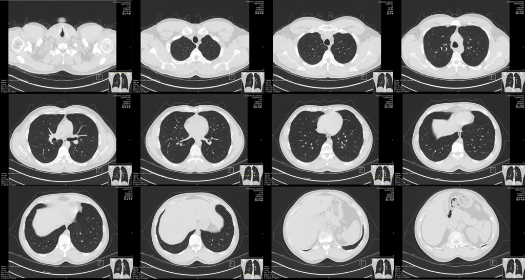 Downloading and Preprocessing Medical Images in Bulk: DICOM to NumPy ...