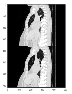 Downloading and Preprocessing Medical Images in Bulk: DICOM to NumPy ...