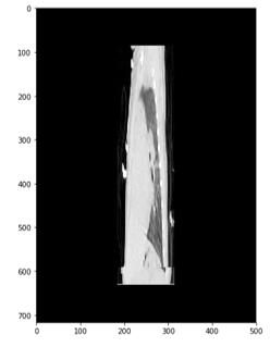 Downloading and Preprocessing Medical Images in Bulk: DICOM to NumPy ...